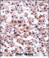 RCAN3 Antibody (C-term)